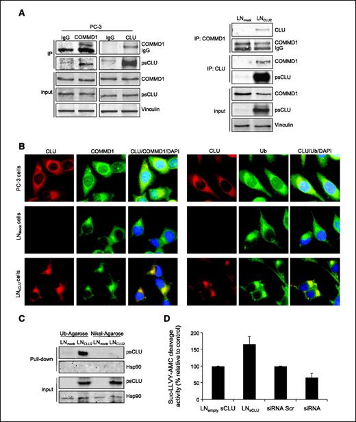 FIGURE 1. sCLU is a COMMD1 and ubiquitin partner in prostate cancer cells. A. sCLU interacts with COMMD1. Total proteins from PC-3, LNmock, and LNsCLU were co-IP with anti-CLU or normal IgG followed by Western blotting using COMMD1 antibody. The inverse experiment was done using COMMD1 antibody for co-IP. CLU, COMMD1, and vinculin were used for Western blotting (sCLU is detected as a 60-kDa glycosylated presecretory form of sCLU and is referred as psCLU in all Western blot analyses, as proposed in ref. 43). B. sCLU colocalizes with COMMD1 and ubiquitin (Ub). Immunofluorescence was done in PC-3, LNmock, and LNsCLU using CLU, COMMD1, and ubiquitin antibodies and 4′,6-diamidino-2-phenylindole (DAPI) for nuclei staining. C. sCLU associates with ubiquitin. Total proteins were incubated with ubiquitin-agarose matrix or nickel-agarose, and bound protein and input were used for Western blots with CLU and Hsp90 antibodies. D. sCLU enhances ubiquitinated proteins. Total proteins (50 μg) from LNmock and LNsCLU or PC-3 treated with sCLU or Scr siRNA were monitored for cleavage of Suc-LLVY-AMC. Fluorescence was quantified using a spectrofluorometer (Fluoroskan Ascent FL, Thermo Labsystem). Columns, mean; bars, SE. *, P < 0.05, statistical significance from three biological replicates.