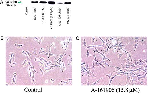 Fig. 8. Effect of A-161906 and reference HDAC inhibitors on gelsolin expression in T24 bladder carcinoma cells. T24 bladder carcinoma cells were plated at 1.0 × 106 cells/100-mm tissue culture dish and allowed to adhere overnight. Cells were treated with A-161906 and the reference HDAC inhibitors TSA and MS-275 for 24 h. Gelsolin expression (A) was analyzed by Western blot using 50–100 μg total cell lysate/lane as described for p21 in “Materials and Methods.” Cell images were taken after 24-h compound exposure, control cells (B) demonstrated ruffled edges characteristic of growing T24 cells, and A-161906-treated cells (C) demonstrated a more spindle-like cell shape without ruffled edges.