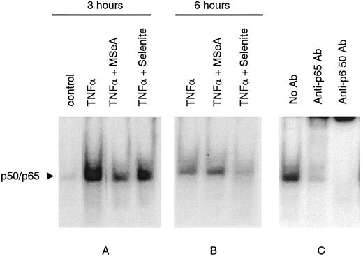 Fig. 3. Effect of selenium compounds on induced κB binding in JCA1 prostate cells. A and B, EMSA analysis of κB binding. Cells were pretreated for 30 min with MSeA (5 μm) or sodium selenite (5 μm) without medium change. Then TNF-α (3.5 ng/ml) was added to the medium, and incubation was continued. Cells were harvested at the indicated time points, and nuclear and cytosol extracts were prepared. EMSA was performed by incubating nuclear proteins with a labeled κB-oligonucleotide. C, identification of nuclear κB binding complexes was analyzed by EMSSA. Nuclear proteins from JCA1 cells were incubated with a labeled κB nucleotide and antibodies against p50 and p65 proteins, and DNA binding was analyzed.