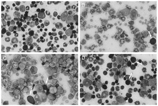 Fig. 2. Representative bone marrow smears from mice treated with vehicle alone (A) or 21.25 μmol/kg 6-TG (B), trans-AVTG (C), or cis-AVTP (D) for two cycles as described in “Materials and Methods.” Arrows indicate the darkly stained erythroid precursors. Note the low numbers of erythroid cells in C and their rare presence in B. ×600.