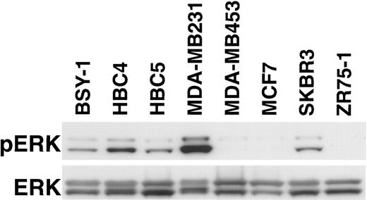 Fig. 2. Phosphorylation and protein levels of ERK in human breast tumor cell lines. Cell lysates were electrophoresed through 10% SDS-PAGE, followed by immunoblotting using anti-phospho-ERK or a mixture of anti-ERK1 and anti-ERK2 antibodies. pERK, phosphorylated ERK. Samples were prepared from anchored cells. Similar results were obtained with nonanchored cells (not shown).