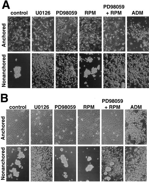 Fig. 7. Morphologies of anchored or nonanchored MDA-MB231 (A) and HBC4 (B) cells treated with U0126, PD98059, rapamycin (RPM), PD98059 plus rapamycin, or Adriamycin (ADM). Cells were treated for 48 h as in Fig. 6.