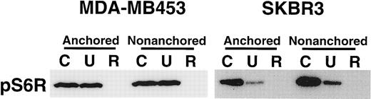 Fig. 9. Immunoblot analysis of phosphorylation level of S6 ribosomal protein in anchored or nonanchored MDA-MB453 and SKBR3 cells treated for 24 h with U0126 (U) or rapamycin (R). Concentrations used were: U0126, 10 μm; rapamycin, 25 nm. Cell lysates were electrophoresed through 10% SDS-PAGE followed by immunoblotting using anti phospho-S6 ribosomal protein antibody. pS6R, phosphorylated S6 ribosomal protein; C, vehicle control.