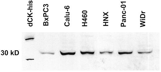Fig 2. Western analysis of dCK expression at the 30,000 Mr position in some of the xenografts with the dCK-his as reference. Lanes represent, as indicated in the figure, dCK-his, BxPC3, Calu-6, H460, HNX-22B, PANC-01, and WiDr, respectively. Because of the his-tag, dCK-his has a higher molecular weight than natural dCK.