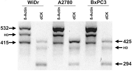 Fig 4. Expression of dCK mRNA in three human xenografts. The blot shows three bands for both dCK and β-actin; 425 and 532 are the number of bp encoded by the forward and reverse primers for the native cDNA of dCK and β-actin, respectively; 294 and 415 are the number of bp encoded by the competitive templates for dCK and β-actin, respectively. HD represent a heterodimer, which can be formed between the native cDNA and the competitive template. The contribution of the HD was calculated as described previously (34, 35). The bands were scanned and the optical density was used to calculate a ratio between the native cDNA and competitive template of each target; thereafter these ratios were used to calculate the ratio for dCK:β-actin.