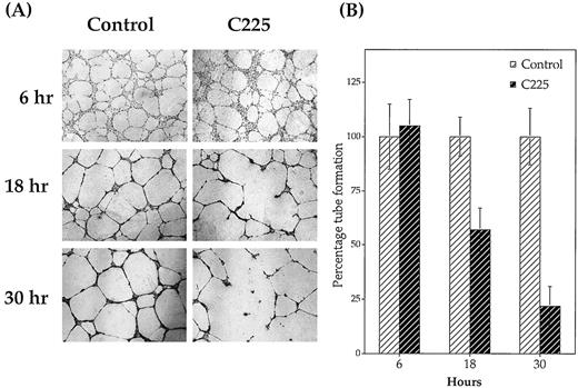 Fig. 4. Effect of C225 on capillary-like network (tube) formation in HUVEC cells. Tissue culture plates were coated with 250 μl Matrigel for 1 h, and HUVEC cells (1000 cells/ml/well) were added with or without C225 (30 nm). At 6, 18, and 30 h, plates were fixed and stained. A, photomicrographs of tube formation in the absence or presence of C225. B, average number of tubes per microscopic field from three separate experiments. Data were normalized to the control group for each time interval; bars, ±SE.