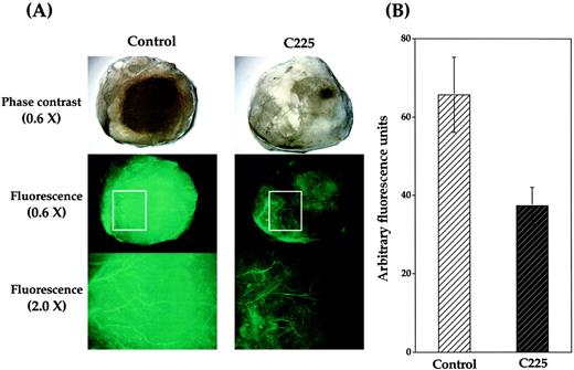 Fig. 5. Effect of C225 on tumor xenograft angiogenesis. SCC-1 cells were implanted in athymic mice as described in “Materials and Methods.” Biweekly administration of C225 (0.8 mg in 0.4 ml) or PBS was initiated on day 5. On day 21, mice were injected (i.v.) with FITC-dextran before removal of Matrigel plugs and examination using phase-contrast and fluorescence microscopy. A, blood vessel distribution visualized (green) under fluorescence microscopy. Bottom panels represent higher resolution photographs (×2) taken from the designated box within the middle panels. B, the intensity of fluorescence was additionally quantified as described in “Materials and Methods.” The results were obtained from 6 mice/group in two independent experiments; bars, ±SD.