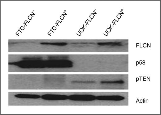 Figure 5. Basal level of cellular protein expression in UOK and FTC cells with/without FLCN Expression. Western blotting was carried out by using antibodies as described in Materials and Methods.
