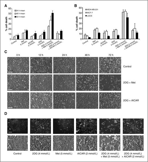 Figure 2. 2DG combined with metformin selectively promotes death of cancer cells. Cell viability was assessed by trypan blue exclusion. Data are the mean ± SD (n = 3) of at least 100 cells from one representative experiment of at least 4 independent experiments. A, p-SK4 cells were treated with indicated agents and viability was assessed. B, viability of breast (MDA-231 and MCF-7) and osteosarcoma (U2OS) cell lines was assessed at 72 hours. C, p-SK4 cells were treated with 2DG + Met or 2DG + AICAR for the indicated times and representative photomicrographs taken. Scale bar, 100 μm. D, GFP-LC3–transfected U2OS cells were incubated for 72 hours with the indicated compounds (top, fluorescence analysis; bottom, bright fields; scale bars, 100 μm).