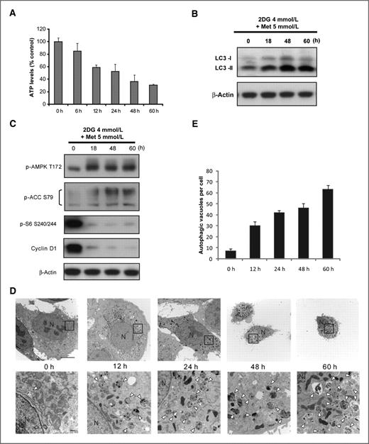 Figure 4. Prolonged incubation with 2DG and metformin depletes cellular ATP, activates AMPK, suppresses mTORC1 downstream signaling, and sustains autophagy. p-SK4 cells were incubated with 2DG and metformin for the indicated times. A, cellular ATP levels were determined. Data are the mean ± SD (n = 3). B, Western blotting for LC3 expression. β-Actin was used as loading control. C, kinetics of signaling molecules in AMPK and mTORC1 downstream. Western blotting of samples from (4B). D, TEM analysis of morphologic alteration of cells treated with 2DG in combination with metformin. Severe cytoplasmic contraction and resultant membrane blebbing is evident (48 and 60 hours). Note most of the cytoplasm is replaced with autophagosomes (60 hours). Neither typical apoptotic nor necrotic cells are evident (N, nucleus; arrowheads, autophagosome; scale bar, 10 μm for top; 500 nm for bottom). E, autophagic vesicles were counted for 3 randomly selected cells from each electron microscopy section. Data presented mean ± SD.