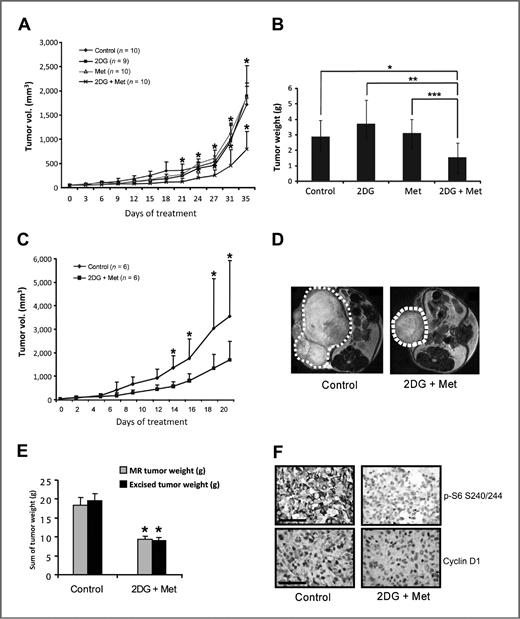 Figure 6. Effects of 2DG and metformin on xenograft tumor growth. A, tumors were established in athymic nude female mice by mammary fat pad injection of 6.5 × 106 MDA-MB-231 cells and treated as described in Materials and Methods. The mean tumor volume ± SD is presented. *, P < 0.05 compared with control, 2DG alone, or metformin alone. B, ex vivo tumor weight of tumors from A. *, P < 0.05; **, P < 0.01, and ***, P = 0.01. C, tumors were established in athymic nude female mice by subcutaneous injection of 4 × 106 s-SK4 cells and treated as described in Materials and Methods. Mean tumor volume ± SD is presented. *, P < 0.05. D, representative MR images. E, tumor weight by 2DG + metformin as assessed by in vivo MRI and excised tumors. *, P < 0.05. F, immunohistochemical analysis of p-S6 and cyclin D1 levels in paraffin-embedded xenograft tumor tissues. Scale bar, 100 μm.