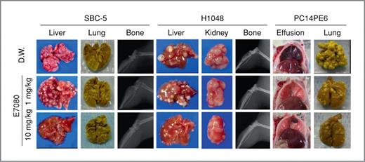 Figure 3. E7080 inhibition of the enlargement of hematogenous multiple organ metastases of lung cancer cells bearing nonmutant EGFR in immunodeficient mice. SBC-5 and H1048 cells were inoculated intravenously into NK cell–depleted SCID mice, whereas PC14PE6 cells were intravenously inoculated into nude mice. Mice received oral E7080 on days 14 to 35 after inoculation with SBC-5 or PC14PE6 cells and on days 28 to 56 after inoculation with H1048 cells. Representative pictures of 5 to 8 mice per group are shown. D.W., distilled water.