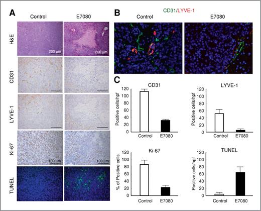 Figure 4. E7080 inhibition of angiogenesis and lymphangiogenesis in liver metastases of SBC-5 cells. A, liver metastatic nodules produced by SBC-5 cells with or without E7080 (10 mg/kg) treatment were stained for hematoxylin and eosin (H&E), endothelial cells (CD31), lymph endothelial cells (LYVE-1), proliferating human tumor cells (Ki-67), and apoptotic cells (TUNEL). Bars indicate 200 μm for H&E, CD31, and LYVE-1, and 100 μm for Ki-67 and TUNEL. B, the same nodules were double stained for CD31 (red) and TUNEL (green) to detect apoptotic endothelial cells. C, number of cells positive for CD31, LYVE-1, Ki-67, and TUNEL in 5 areas (×200). Bars indicate SDs.