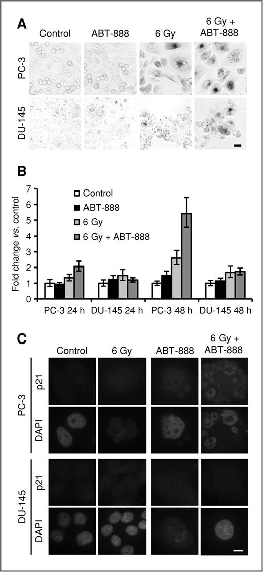 Figure 4. Accelerated senescence in DU-145 and PC-3 cells induced by ABT-888 and IR, alone or in combination. A, analysis of SA-β-Gal activity 7 days after treatment showed that 6 Gy with or without 10 μmol/L ABT-888 increased SA-β-Gal activity in PC-3 cells. IR alone had less effect on DU-145 cells, which showed some increase in SA-β-Gal staining with IR + ABT-888. Bar, 20 μm. B, qPCR analysis of p21 expression showed a significant increase only in PC-3 cells 48 hours after 6 Gy with 10 μmol/L ABT-888. Bars, SD. C, immunofluorescence analysis at 72 hours after treatment showed significant accumulation of p21 protein only in PC-3 cells treated with both IR and ABT-888. Bar, 10 μm.