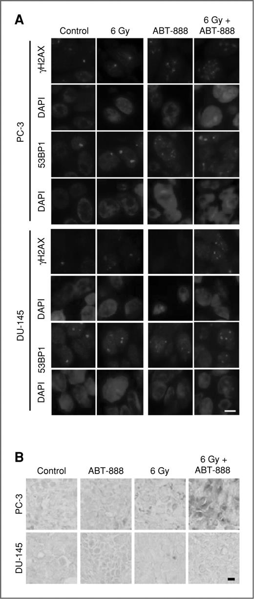 Figure 5. Foci persistence and accelerated senescence in PC-3 and DU-145 tumors treated with ABT-888 and IR, alone or in combination. A, immunofluorescence staining in PC-3 and DU-145 tissue sections from tumors harvested 4 days after treatment with ABT-888 ± IR. Both cell lines display small numbers of γH2AX and endogenous 53BP1 nuclear foci 4 days after 6 Gy alone. ABT-888 increased the number of persistent foci in PC-3 but had a less marked effect on DU-145 tumors. Bar, 10 μm. B, tumors excised at 7 days after treatment, sectioned, and analyzed for SA-β-Gal display increased activity in PC-3 tumors after treatment with IR + ABT-888. DU-145 tumors show only isolated cells with SA-β-Gal staining. Bar, 20 μm.