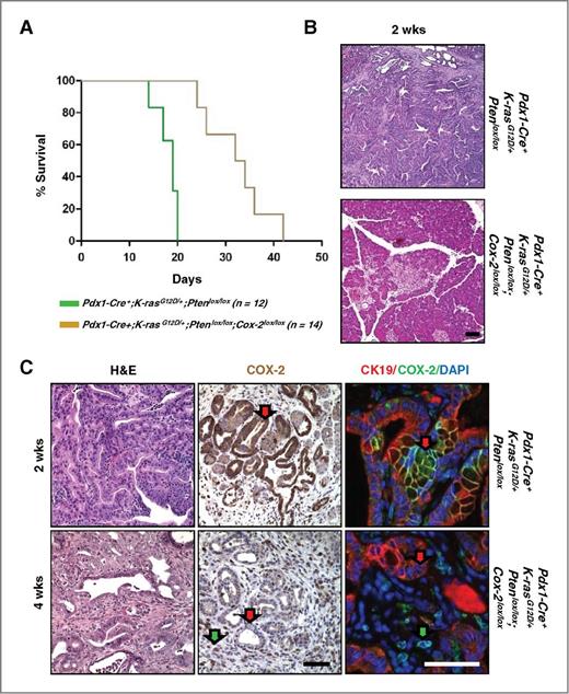 Figure 2. Targeted Cox-2 deletion causes delayed tumor onset and increased life expectancy in the Pdx1-Cre;K-ras; Pten mouse model. A, Kaplan–Meier analysis comparison of Pdx1-Cre+;K-rasG12D/+;Ptenlox/lox and Pdx1-Cre+;K-rasG12D/+;Ptenlox/lox;Cox-2lox/lox mice. B, histology of Pdx1-Cre+;K-rasG12D/+;Ptenlox/lox and Pdx1-Cre+;K-rasG12D/+;Ptenlox/lox;Cox-2lox/lox mice. C, histology and COX-2 immunohistochemistry or double immunofluorescence [cytokeratin-19 (CK-19), COX-2], as indicated, on tumors of Pdx1-Cre+;K-rasG12D/+;Ptenlox/lox (enlarged version of B) and Pdx1-Cre+;K-rasG12D/+;Ptenlox/lox;Cox-2lox/lox mice. Scale bars, 50 μm. DAPI, 4′,6-diamidino-2-phenylindole.