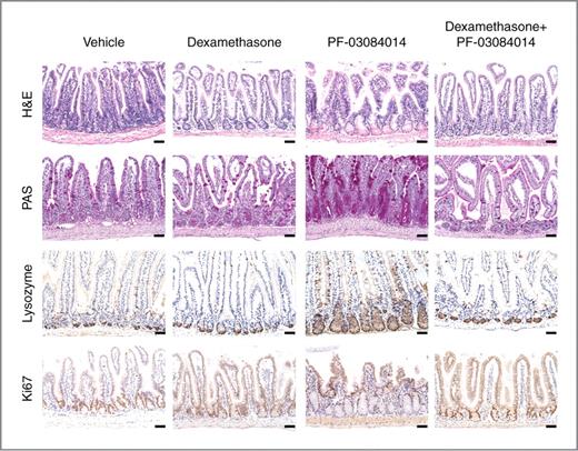 Figure 5. Glucocorticoids reverse PF-03084014–induced goblet cell metaplasia. Histologic and immunohistochemical analysis of distal ileum sections from mice treated for 5 days with vehicle, 15 mg/kg dexamethasone, 150 mg/kg PF-03084014, or dexamethasone plus PF-03084014. Scale bars represent 50 μm. H&E, hematoxylin and eosin stain.