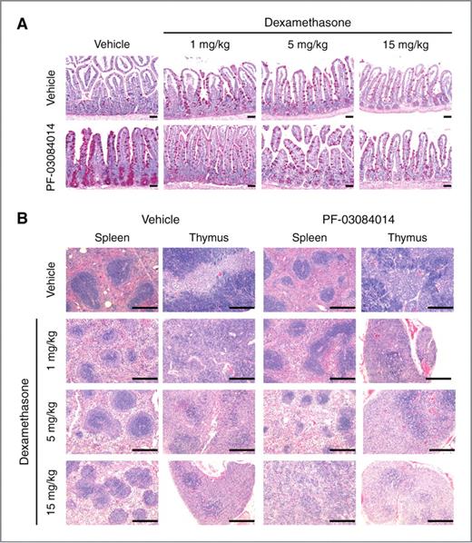 Figure 6. Dose reduction of dexamethasone for the reversal of PF-03084014–induced gastrointestinal toxicity. A, periodic acid Schiff (PAS) stain of distal ileum sections harvested from mice treated for 5 days with vehicle, dexamethasone (1, 5, or 15 mg/kg), 150 mg/kg PF-03084014, or dexamethasone plus PF-03084014. B, hematoxylin and eosin stain of spleens and thymi harvested from mice in A. Scale bars represent 50 μm (intestines) or 400 μm (spleen, thymus).