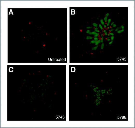 Figure 3. Representative images from HeLa cells expressing GFP-H2B and immunostained for PLK1. A, normal metaphase from an untreated cell, aberrant prometaphase from a cell transfected with 5743 (B), aberrant, quadripolar metaphase from a cell transfected with 5743 (C), aberrant, tripolar metaphase from a cell transfected with 5788 (D).