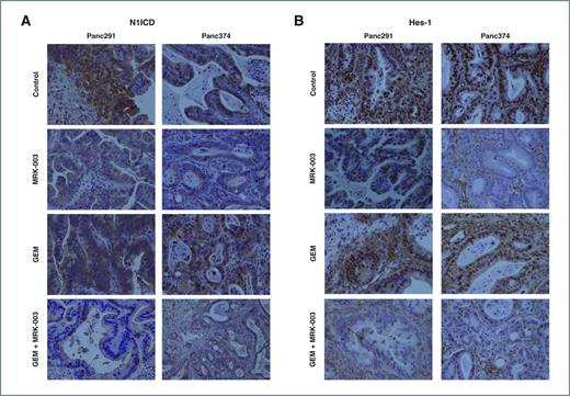 Figure 6. MRK-003 treatment downregulates nuclear N1ICD and Hes-1 protein expressions in PDAC xenografts as shown by immunohistochemical staining. A and B, representative photomicrographs of N1ICD and Hes-1 from Panc291 and Panc374 xenografts showing downregulation of nuclear N1ICD and Hes-1 expression in MRK-003 and combination of gemcitabine and MRK-003 treatment compared with the vehicle-treated and gemcitabine-treated tumor samples. GEM, gemcitabine.