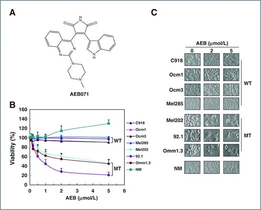 Figure 1. Effect of AEB071 on GNAQ wild-type and mutated uveal melanoma cells. A, molecular structure of AEB071 (sotrastaurin; adapted from ref. 43). B, AEB071 selectively reduced viability of uveal melanoma cells harboring GNAQ mutations. Cells were treated with varying amount of AEB071 for 72 hours. Data are presented as mean ± SD of 4 or 5 independent experiments. NM, normal melanocytes; WT, GNAQ wild-type; MT, GNAQ mutation. C, AEB071 caused morphologic alterations in GNAQ-mutated cells. After AEB071 treatment for 3 days, Mel202, 92.1, and Omm1.3 cells lost spindle shape and became flattened with increased size or round floating dead cells with condensed cytoplasm. The morphology of GNAQ wild-type uveal melanoma cells was not altered by AEB071.