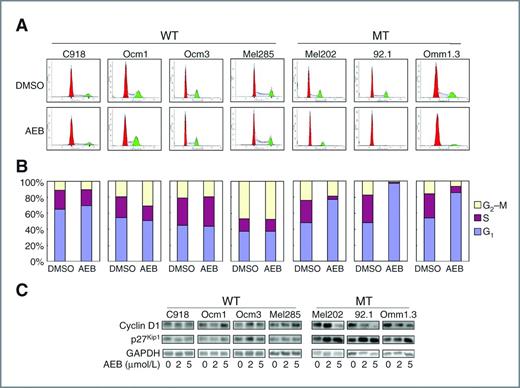 Figure 2. AEB071 induces G1 arrest in uveal melanoma cells harboring GNAQ mutations. A, uveal melanoma cells were treated with DMSO or 5 μmol/L AEB071 for 24 hours and subjected to cell-cycle analysis. B, bar graphs of percentages of G1, S, and G2–M populations. C, AEB071 selectively increased p27 and decreased cyclin D1 expression in GNAQ mutant uveal melanoma cells. Cells were treated with 0, 2, or 5 μmol/L AEB071 for 72 hours and analyzed by immunoblot. WT, GNAQ wild-type; MT, GNAQ mutation.