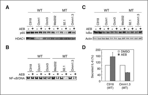 Figure 6. AEB071 selectively inhibited NF-κB activation in uveal melanoma cells harboring GNAQ mutations. A, immunoblot analysis of nuclear RelA (p65) levels of uveal melanoma cells treated with 0 or 5 μmol/L AEB071 for 40 hours. HDAC1 (histone deacetylase 1) was used as loading control for nuclear extracts (56). B, EMSA analysis of NF-κB DNA-binding activity in the same nuclear extracts used in A. NF-κB/DNA complexes were determined as described in Materials and Methods. C, AEB071 increased IκBα protein levels in uveal melanoma cells with mutated GNAQ. Cells were treated with DMSO or 5 μmol/L AEB071 for 20 hours and subjected to immunoblot analysis of IκBα. D, AEB071 reduced IL-6 secretion from Omm1.3 cells. Cells were treated with DMSO or 5 μmol/L AEB071 for 72 hours. Medium was collected for ELISA analysis of IL-6. Data are presented as mean ± SD of percent secretion of 3 independent experiments. *, P < 0.05.