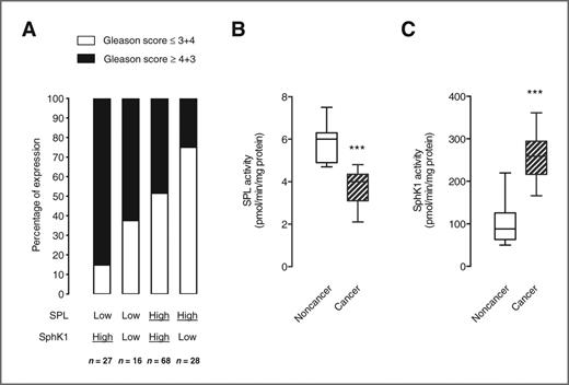 Figure 2. An inverse relationship exists between SPL and SphK1 protein expression and enzymatic activity in human prostate cancer. A, semiquantitative analysis of the relationship between combined SPL and SphK1 expression and Gleason score. Staining intensity was scored as low (sum of negative and faint/equivocal) and high (sum of moderate and strong). The n value represents the number of spots for which both SphK1 and SPL expression were evaluated (total n = 139). SPL (B) and SphK1 (C) activities were quantified in 13 individual pairs of cancer and noncancerous lesions (see Material and Methods section, tissue procurement). Median SPL activities were 6.0 (95% CI, 5.2–6.2) and 4.0 (95% CI, 3.1–4.2) pmol/min/mg of protein in noncancerous and tumor samples, respectively (P < 0.0001). Median SphK1 activities were 88 (95% CI, 71–129) and 259 (95% CI, 223–289) pmol/min/mg of protein in noncancerous and tumor samples, respectively (***, P < 0.0001).