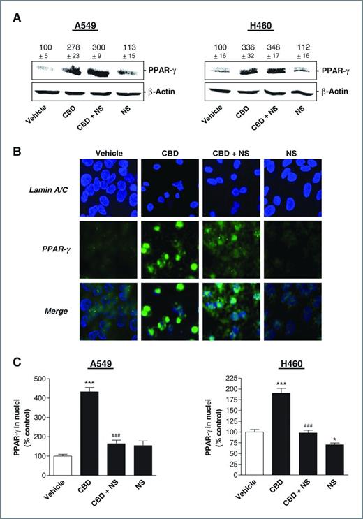 Figure 5. Impact of COX-2 on PPAR-γ expression and activation. A, PPAR-γ protein levels in cells treated with 3 μmol/L cannabidiol (CBD) in the presence or absence of 1 μmol/L NS-398 for 8 hours. β-Actin was used as loading control for Western blot analysis. Values above the blots represent videodensitometric analysis given as percentage of vehicle control. B, evaluation of nuclear PPAR-γ by confocal microscopy in cells incubated with 3 μmol/L cannabidiol in the presence or absence of 1 μmol/L NS-398 for 18 hours. C, densitometric quantification of PPAR-γ in nuclear regions. In all cases NS-398 was added to cells 1 hour before cannabidiol or vehicle and the incubation was continued for the indicated time. Values are mean ± SEM of n = 4 (A, left) or n = 3 (A, right) experiments. *, P < 0.05; ***, P < 0.001 vs. vehicle; ###, P < 0.001 vs. cannabidiol.