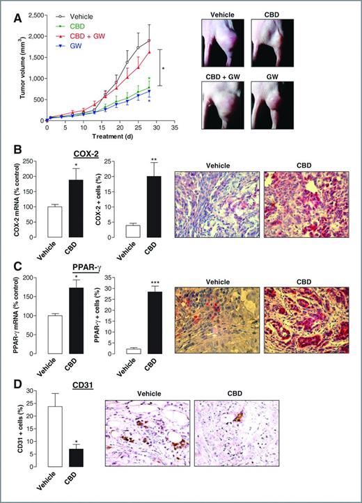 Figure 7. Tumor-regressive action of cannabidiol (CBD) in vivo. Animals were treated with either vehicle or cannabidiol every 72 hours (5 mg/kg) in the presence or absence of GW9662 (1 mg/kg). A, tumor volumes are mean ± SEM of n = 5–7 animals per group. *, P < 0.05 for cannabidiol versus vehicle (green asterisk), GW9662 versus vehicle (blue asterisk), cannabidiol versus cannabidiol + GW9662 (black asterisk). B–D, immunhistochemical protein analyses were obtained from animals treated with cannabidiol or vehicle. Quantification of COX-2 and PPAR-γ mRNA was conducted by real-time RT-PCR (B and C, left). Quantification of COX-2, PPAR-γ, and CD31 (vascularization marker) protein levels (B and C, middle; D, left) was achieved by counting positively stained cells from different animals. Data represent mean of n = 3–4 (mRNA), n = 4 (CD31), or n = 5 (COX-2, PPAR-γ, protein) different tumors per group. *, P < 0.05; **, P < 0.01; ***, P < 0.001 vs. vehicle.