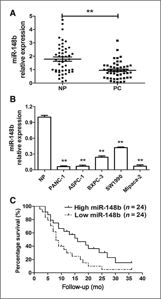 Figure 1. Analysis of miR-148b expression in human pancreatic cancer tissues and cell lines by qRT-PCR. A, the relative expression levels of miR-148b in human pancreatic cancer specimens (n = 48) and matched adjacent noncancerous pancreatic tissues (n = 48). PC, pancreatic cancer tissue; NP, adjacent noncancerous pancreatic tissues. B, expression of miR-148b in 5 pancreatic cancer cell lines (PANC-1, ASPC-1, BXPC-3, SW1990, and Miapaca-2). Data are presented in pancreatic cancer cell lines relative to control. There is no normal pancreatic cell line, so we randomly chose 3 normal pancreatic tissues as control. U6 was used as a control for RNA loading, and miRNA abundance was normalized to U6 RNA. **, P < 0.01 compared with control. C, Kaplan–Meier curves of overall survivals of 48 patients with pancreatic cancer according to miR-148b expression scored as low expression (less than the median value, n = 24) and high expression level (more than the median value, n = 24).