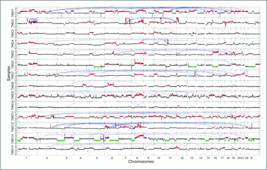 Figure 2. Integrated genome-wide comparative genomic hybridization and structural rearrangements in mTNBC. Chromosome and genome positions are plotted across the X-axis, and log2 FC is plotted on the Y-axis. Copy number plots are colored red for amplified regions (log2 fold-change > 1.5) or green (log2 fold-change < 1). Blue lines show connection of trans regions based on discordant sequence read pairing.