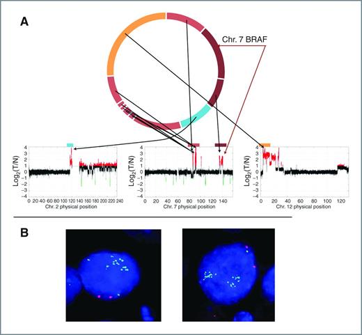 Figure 4. Chromosomal alteration encompassing the BRAF locus in mTNBC2. A, reconstruction of mTNBC2 double minute based on analysis of long-mate pair anomalous reads and copy number loss/gain calculations. Arrows show a copy number amplification is observed at breakpoints linking several segments from chromosomes 1, 7, and 12. In the lower plots, the fold-change is plotted, estimated by log2(CG)–log2(CT) in which CG and CT are normalized coverage for germline and tumor, respectively. B, BAC-FISH validation of BRAF locus containing double minutes in mTNBC2. BAC clones were labeled with a green fluorophor and BACs containing chromosome 7 centromeres were labeled with a red fluorophor.