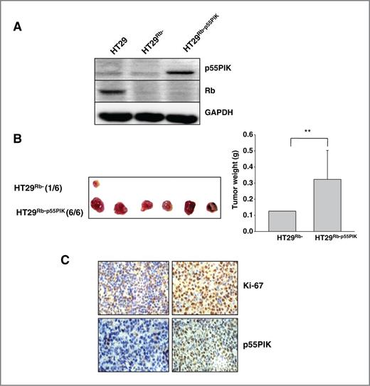 Figure 4. p55PIK stimulates tumorigenesis in vivo. A, increased p55PIK expression in HT29 cells with minimal level of Rb proteins (HT29Rb-). HT29Rb− cells were transfected with pcDNA-p55PIK or control vector pcDNA and clones with increased expression of p55PIK were selected in the presence of G418 (HT29Rb-p55PIK) and further studied. Cell lysates from HT29Rb− (control), pcDNA-p55PIK-transfected, and pcDNA-transfected HT29Rb− cells were loaded on a gel and p55PIK or Rb protein expression was assessed by Western blotting using anti-p55PIK antibody or anti-Rb antibody. B, tumor xenograft growth from cells HT29Rb− or HT29Rb-p55PIK. Cells were subcutaneously injected into nude mice (1 × 105 per site, six sites). Two weeks later, mice were sacrificed and tumors were collected and weighed. (mean + SD; n = 6; **, P < 0.01; HT29Rb-p55PIK group compared with HT29Rb− group). C, bottom, increased expression of p55PIK and Ki-67 in HT29Rb-p55PIK tumor xenografts. Immunohistochemical analyses were conducted on tumor xenografts to examine the expression of p55PIK as well as Ki-67 proteins.