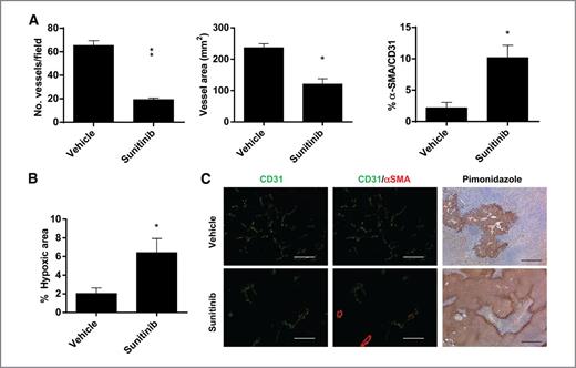 Figure 4. Pharmacodynamic analyses on LLC from sunitinib-treated and time-matched control tumors. LLC tumor-bearing mice were treated as in Fig. 2A for 7 days, and vessel morphology was analyzed (5 per group). A, from left to right, vessel number and vessel area, by CD31 immunostaining; vessel maturation index by CD31/α-SMA double staining (% α-SMA/CD31 double-positive vessels/total vessels; A). B, percentage intratumor hypoxic area (pimonidazole adduct) per field; (mean ± SEM; *, P < 0.05; **, P < 0.01). C, representative images of vessel morphology; from left to right: CD31, α-SMA/CD31 (scale bar. 100 μm), pimonidazole (scale bar. 400 μm).