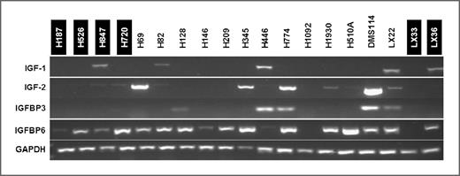 Figure 3. Expression of IGF-1R ligands and binding proteins does not correlate with sensitivity to OSI-906 in SCLC cell lines. RNA was isolated and reverse transcribed from SCLC cell lines and cell lines derived from primary patient tumors (LX) for use in RT-PCR expression analyses. Data shown are representative of several independent experiments.