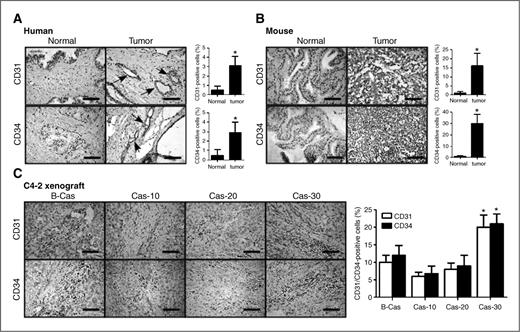 Figure 1. Endothelial cells/microvasucles are increased in prostate cancer versus normal tissues. A and B, IHC staining of normal prostate and prostate tumor tissues. A, human patient tissues; arrows, CD31/CD34-positive cells. B, TRAMP mouse tissues. Human normal prostate and prostate tumor tissues were obtained from young (about 30 years of age) normal organ donors and patients with radical resection of prostate cancer, respectively, at the Shanghai First People's Hospital (Shanghai, China). TRAMP tumors were obtained from 28-week-old TRAMP mice (B6 background). C, IHC staining of C4-2 orthotopic xenografted tumor tissues before (B-Cas) and after castration. C4-2 cells were orthotopically injected into anterior prostates of mice. After tumors developed, mice were castrated and castration-resistant tumors allowed to redevelop. Mice were sacrificed 10, 20, and 30 days after castration and tumors were obtained. Tumors from some mice before castration were used as controls. Tumor tissues were immunohistochemically stained with CD31 and CD34 antibodies. *, P < 0.05.