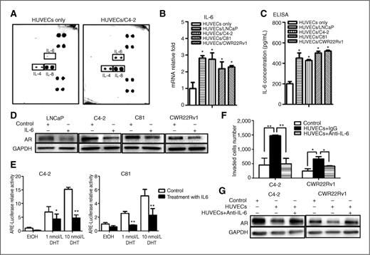 Figure 4. IL-6 is a potential mediator to downregulate AR signaling, which in turn, enhances invasion ability of prostate cancer cells. A, cytokine array analysis. HUVECs were cocultured with or without C4-2 cells for 2 days and the conditioned media collected for cytokine array analysis. B, quantitative PCR analysis showing mRNA levels of IL-6. Total RNAs were extracted from HUVECs, either with or without coculture with prostate cancer cells, cDNAs obtained by reverse transcriptase reaction, and the mRNA levels of IL-6 were analyzed. C, IL-6 ELISA assay result showing increase in IL-6 secretion in prostate cancer cells upon coculture with HUVECs. HUVECs were cocultured with LNCaP, C4-2, C81, and CWR22Rv1 cells for 2 days and the conditioned media collected for ELISA. D, LNCaP, C4-2, C81 and CWR22Rv1 cells (1 × 105/well) were treated with 20 ng/mL of human recombinant IL-6 (Prospec Bio) for 6 hours. Prostate cancer cell extracts were used for Western blot analysis for AR expression. E, C4-2 and C81 cells were transfected with MMTV-luc containing ARE. After transfection, cells were treated with 20 ng/mL of IL-6 for 24 hours in the presence of various concentrations of DHT as indicated, and luciferase activity was measured. F, C4-2 and CWR22Rv1 cells were cocultured with HUVECs in the presence of anti-IL-6–neutralizing antibody (R&D Systems; normal immunoglobulin G as control) for 2 days and invasion assay was conducted. G, prostate cancer cell extracts were obtained under the similar conditions as in F and used for the Western blot analysis for AR. Data are mean ± SD. *, P < 0.05; **, P < 0.01.