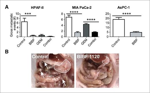 Figure 2. BIBF 1120 decreases gross metastatic burden in orthotopic pancreatic xenografts. A, at sacrifice, the number of gross metastatic events was recorded. Gross metastatic burden was decreased significantly in BIBF 1120–treated animals compared with control groups in each model. B, representative image of a HPAF-II tumor presentation at the time of sacrifice. Dashed lines, primary tumor borders; arrows, metastatic foci; Gem, gemcitabine. Bar graphs indicate mean + SEM. ***, P < 0.001; ****, P < 0.0001 by Student t test/Dunn posttest.