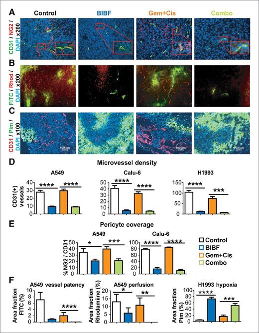 Figure 3. BIBF 1120 shows potent antiangiogenic effects, decreases perfusion, and induces hypoxia in lung cancer xenografts. Vascular parameters of NSCLC tumors were evaluated by immunohistochemistry and perfusion studies. A, representative images of MVD (CD31) and pericyte coverage (NG2) in Calu-6 xenografts at ×200 magnification (inset, ×400), with 4′,6-diamidino-2-phenylindole (DAPI)-labeling nuclei. B, representative images of perfusion of high-molecular weight (FITC; MW, 2 million daltons) and low-molecular weight [rhodamine (Rhod); MW, 10,000 daltons] dextrans in A549 xenografts. C, representative images of hypoxia as assessed by pimonidazole staining in H1993 xenografts. Scale bar, 100 μm. Quantification of MVD (D), pericyte coverage (E), and dextran perfusion data and hypoxia (F). Vessel patency reflects signal from high-molecular weight dextran and perfusion reflects signal from low-molecular weight dextran. Bar graphs indicate mean + SEM. A minimum of 5 images were acquired per group. Results were given as mean percentage of threshold area or absolute vessel counts per ×200 field. *, P < 0.05; **, P < 0.01; ***, P < 0.001; ****, P < 0.0001 by Dunn posttest. Gem, gemcitabine; Cis, cisplatin.