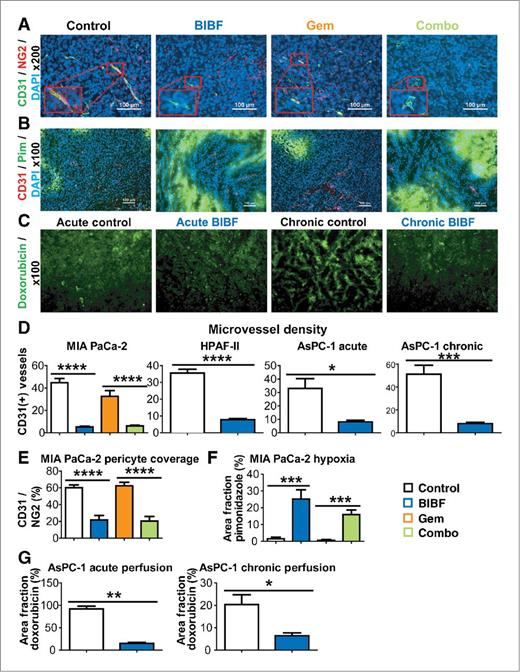 Figure 4. BIBF 1120 shows potent antiangiogenic effects, induces hypoxia, and decreases drug delivery in pancreatic cancer xenografts. Vascular parameters of pancreatic tumors were evaluated by immunohistochemistry and perfusion studies. A, representative images of MVD (CD31) and pericyte coverage (NG2) in Mia PaCa-2 xenografts at ×200 magnification (inset, ×400) with 4′,6-diamidino-2-phenylindole (DAPI)-labeling nuclei. Scale bar, 100 μm. B, representative images of CD31 and pimonidazole reactivity in MIA PaCa-2 xenografts. Scale bar, 100 μm. C, representative images of doxorubicin perfusion in AsPC-1 xenografts after acute or chronic exposure to BIBF 1120. Quantification of MVD (D), pericyte coverage (E), hypoxia (F), and doxorubicin (perfusion) fluorescence (G) is shown. Bar graphs indicate means + SEM. A minimum of 5 images were acquired per group. Results are mean percentage of thresholded area or absolute vessel counts per field. *, P < 0.05; **, P < 0.01; ***, P < 0.001; ****, P < 0.0001 by Dunn posttest. Gem, gemcitabine.