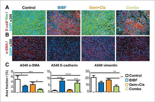 Figure 5. BIBF 1120 does not drive an invasive phenotype in lung cancer. EMT markers from lung tumors were evaluated by immunohistochemistry. A, representative images of mature myofibroblasts (α-SMA) at ×200 magnification with 4′,6-diamidino-2-phenylindole (DAPI)-labeling nuclei. B, representative images of E-cadherin and vimentin at ×200 magnification. C, quantification of fibroblasts, E-cadherin, and vimentin. Bar graphs indicate mean ± SEM. A minimum of 5 images were acquired per group. Results were given as mean percentage of thresholded area per field. *, P < 0.05; **, P < 0.01; ***, P < 0.001; ****, P < 0.0001 by Dunn posttest. Gem, gemcitabine; Cis, cisplatin.