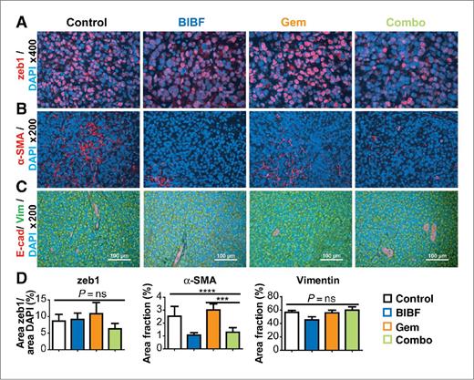 Figure 6. BIBF 1120 does not drive an invasive phenotype in pancreatic cancer. EMT markers from pancreatic tumors were evaluated by immunohistochemistry. A, representative images of zeb1 at ×200 magnification with 4′,6-diamidino-2-phenylindole (DAPI)-labeling nuclei. B, representative images of mature myofibroblasts (α-SMA) at ×200 magnification with DAPI-labeling nuclei. C, representative images of E-cadherin and vimentin at ×200 magnification. Scale bar, 100 μm. D, quantification of zeb1, fibroblasts, E-cadherin, and vimentin. Bar graphs indicate mean ± SEM. A minimum of 5 images were acquired per group. Results were given as mean percentage of thresholded area per field. ***, P < 0.001; ****, P < 0.0001 by Dunn posttest. Gem, gemcitabine; ns, not significant.