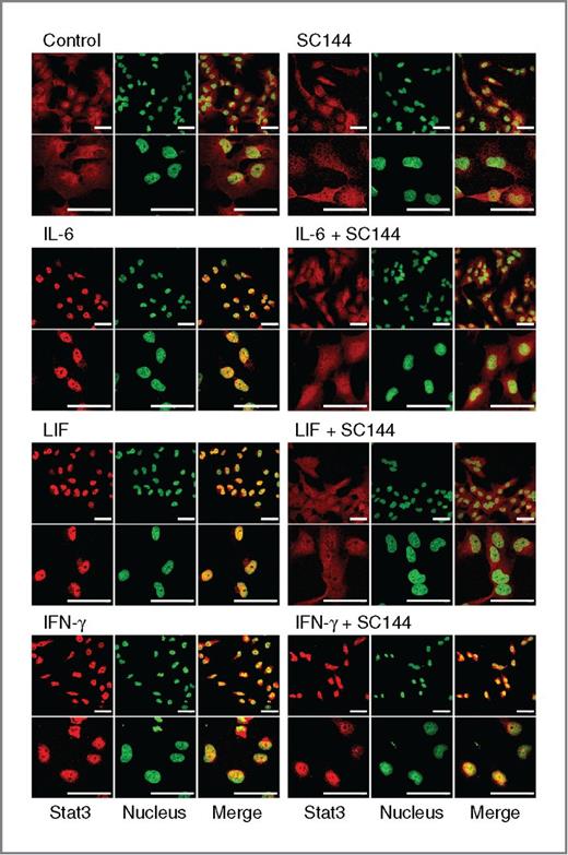 Figure 5. SC144 inhibits Stat3 nuclear translocation induced by gp130 cytokines. OVCAR-8 cells were serum-starved overnight before 4-hour pretreatment with or without SC144 (20 μmol/L), followed by stimulation with indicated cytokines. Images are representative of 3 independent experiments. Scale bar, 50 μm.