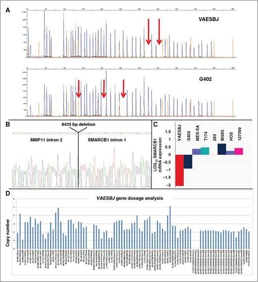 Figure 2. A, SMARCB1 gene dosage analysis by MLPA identified intragenic deletions in VAESBJ and G402 cell lines. B, electropherogram obtained from direct sequencing of the PCR product encompassing the genomic boundaries of SMARCB1 homozygous deletion in VAESBJ cell line. C, quantitative mRNA expression analysis of SMARCB1, showing highly reduced expression in VAESBJ and G402 cell lines compared with SMARCB1 wild-type cell lines. D, copy-number analysis of VAESBJ pseudo-triploid cell line by MLPA identifies SMARCB1 and CDKN2A/B homozygous deletion as the sole genetic abnormalities.