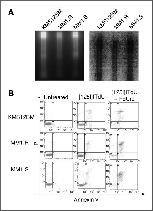 Figure 4. Apoptosis-inducing activity of 125I-ITdU in myeloma stem-like cells. A, DNA fragmentation assay with cells pretreated with FdUrd and exposed to 125I-ITdU (left) and after exposure to a phosphorimager screen (right). B, dot blots represent apoptosis extent using Annexin V/PI staining in untreated, only 125I-ITdU–treated, and FdUrd/125I-ITdU–treated cells. Data are representative of 3 independent experiments.