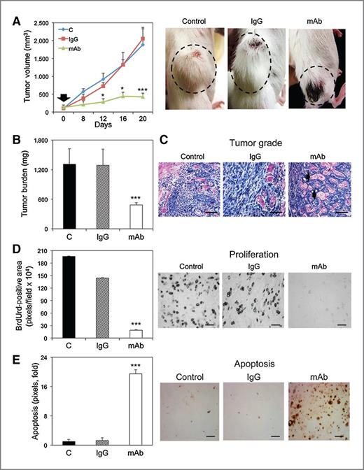 Figure 1. Administration of anti-sEcad mAb suppresses orthotopic cutaneous SCC growth by inhibiting proliferation and inducing apoptosis. Volume (A) and tumor burden (B) of SCC xenograft tumors derived from PAM212 cells upon treatment with saline (n = 6), IgG isotype control (n = 6), or anti-sEcad mAb (n = 7). Error bars, SEM. Insert, representative photomicrographs of saline, IgG, and anti-sEcad mAb-treated tumors. Arrow, black eschar in anti-sEcad mAb-treated tumors. C, H&E-stained sections of anti-sEcad mAb-treated PAM212 skin xenografts demonstrate moderately differentiated tumors with extensive keratin pearls versus poorly differentiated tumors with marked invasive properties in saline and IgG controls. D, BrdUrd quantification and immunohistochemical staining in control and treated tumors (n = 3). E, quantification and immunohistochemical images of TUNEL-positive cells (brown) from resected cutaneous SCC xenografts from saline, IgG versus anti-sEcad mAb-treated mice (n = 3). Data are presented as mean ± SEM. *, P < 0.05; ***, P < 0.001 vs. C or IgG. Scale bars, 25 μm.