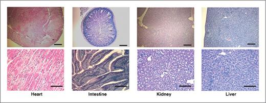 Figure 2. End-organ histology. H&E stains of heart, intestine, kidney, and liver tissues of anti-sEcad mAb-treated SCID mice containing orthotopic SCC xenografts. Blinded histopathologic analysis of anti-sEcad mAb-treated tumors exhibited no evidence of cytotoxicity. Scale bars, 50 μm.