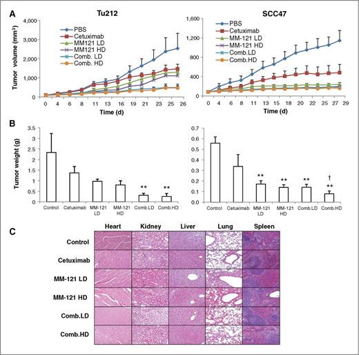 Figure 5. The CM combination inhibits HNSCC xenograft tumor growth in vivo. Mice bearing subcutaneous SCC47 and Tu212 tumors of approximately 100 mm3 were treated by i.p. injection twice per week for 4 weeks with: PBS (phosphate-buffered saline) control, cetuximab (6.25 μg/dose), MM-121 at low dose (300 μg/dose, MM-121.LD), MM-121 at high dose (600 μg/dose, MM-121.HD), the combination with LD MM-121 (comb. LD), and the combination with HD MM-121 (comb. HD). A, tumor volumes were measured three times a week. B, tumors were harvested and weighed 26 (Tu212) and 29 (SCC47) days after the first treatment. C, major organs were harvested for toxicity evaluation by H&E (magnification, ×100). Error bars, mean ± SE of 7 mice from each group; **, P < 0.01 versus control; †, P < 0.05 versus cetuximab.