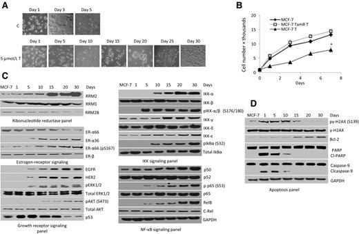 Figure 3. RRM2 is upregulated during the development of tamoxifen resistance. A, morphologic changes in MCF-7 cells upon tamoxifen treatment (bottom) or vehicle control (top), obtained with a 10× objective. B, proliferation of MCF-7TamR cells upon tamoxifen treatment. *, P < 0.05. Western blot analyses of (C) cellular and (D) apoptotic proteins during the emergence of tamoxifen resistance.